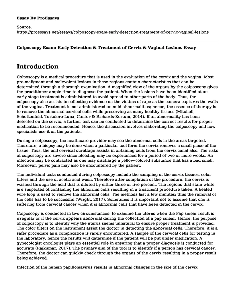 Colposcopy Exam: Early Detection & Treatment of Cervix & Vaginal Lesions